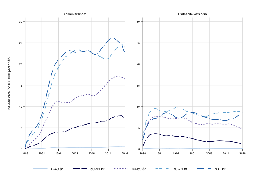 Figur 2. Forekomst (insidensrater) i Norge av plateepitel- og adenokarsinom i spiserøret for ulike aldersgrupper (figur fra Krefregisterets årsrapport (2))  
