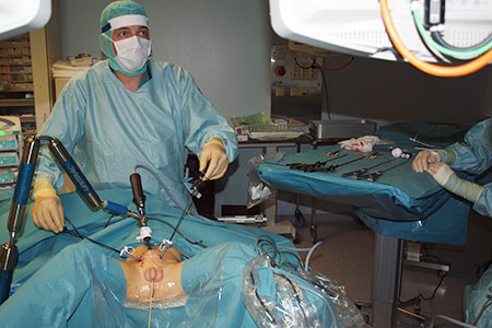 Bilde 4. ”Pneumovesicoscopic” reimplantasjon av ureter i blære. Den første utført i Norge i 2011.