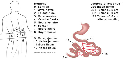 Regioner og score til bruk ved utregning av Peritoneal Carcinomatosis Index.