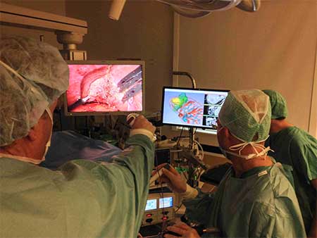 Bruk av 3D modell ved parenkymsparende leverkirurgi.Foto Rahul Kumar, Intervensjonssenteret, Rikshospitalet