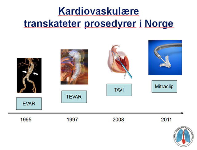 Figur 1. Transkateterbehandling i Norge.